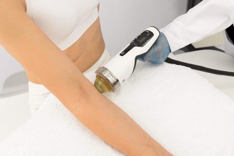 Golfer'elbow shockwave therapy.